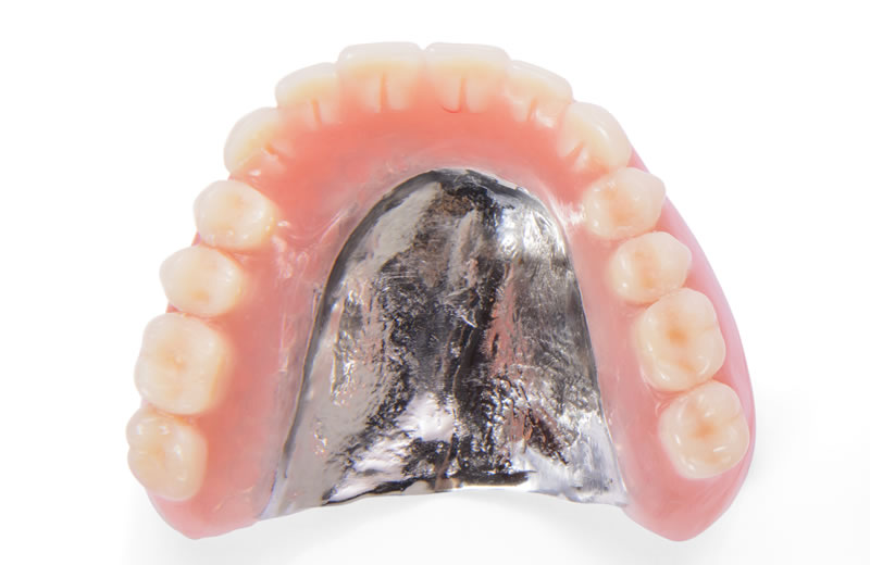 画像：金属床義歯 (総入れ歯)